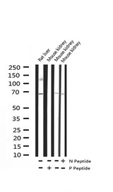 RPS6KB1 / P70S6K / S6K Antibody - Western blot analysis of Phospho-p70 S6 Kinase (Ser371) expression in various lysates