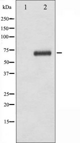 RPS6KB1 / P70S6K / S6K Antibody - Western blot analysis of p70 S6 Kinase phosphorylation expression in serum treated COLO205 whole cells lysates. The lane on the left is treated with the antigen-specific peptide.