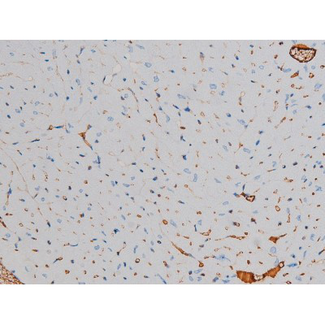 RPS6KB1 / P70S6K / S6K Antibody - 1:200 staining mouse heart tissue by IHC-P. The tissue was formaldehyde fixed and a heat mediated antigen retrieval step in citrate buffer was performed. The tissue was then blocked and incubated with the antibody for 1.5 hours at 22°C. An HRP conjugated goat anti-rabbit antibody was used as the secondary.