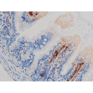 RPS6KB1 / P70S6K / S6K Antibody - 1:200 staining mouse intestinal tissue by IHC-P. The tissue was formaldehyde fixed and a heat mediated antigen retrieval step in citrate buffer was performed. The tissue was then blocked and incubated with the antibody for 1.5 hours at 22°C. An HRP conjugated goat anti-rabbit antibody was used as the secondary.