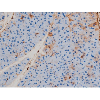 RPS6KB1 / P70S6K / S6K Antibody - 1:200 staining mouse pancreas tissue by IHC-P. The tissue was formaldehyde fixed and a heat mediated antigen retrieval step in citrate buffer was performed. The tissue was then blocked and incubated with the antibody for 1.5 hours at 22°C. An HRP conjugated goat anti-rabbit antibody was used as the secondary.