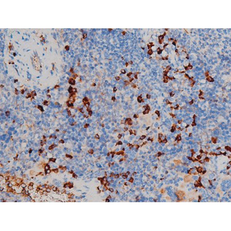RPS6KB1 / P70S6K / S6K Antibody - 1:200 staining mouse spleen tissue by IHC-P. The tissue was formaldehyde fixed and a heat mediated antigen retrieval step in citrate buffer was performed. The tissue was then blocked and incubated with the antibody for 1.5 hours at 22°C. An HRP conjugated goat anti-rabbit antibody was used as the secondary.