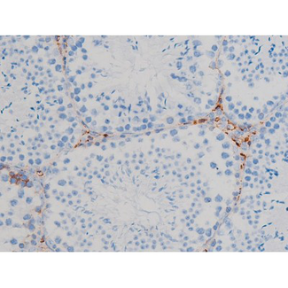 RPS6KB1 / P70S6K / S6K Antibody - 1:200 staining mouse testis tissue by IHC-P. The tissue was formaldehyde fixed and a heat mediated antigen retrieval step in citrate buffer was performed. The tissue was then blocked and incubated with the antibody for 1.5 hours at 22°C. An HRP conjugated goat anti-rabbit antibody was used as the secondary.