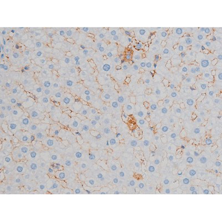 RPS6KB1 / P70S6K / S6K Antibody - 1:200 staining rat liver tissue by IHC-P. The tissue was formaldehyde fixed and a heat mediated antigen retrieval step in citrate buffer was performed. The tissue was then blocked and incubated with the antibody for 1.5 hours at 22°C. An HRP conjugated goat anti-rabbit antibody was used as the secondary.