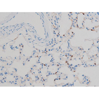RPS6KB1 / P70S6K / S6K Antibody - 1:200 staining rat spleen tissue by IHC-P. The tissue was formaldehyde fixed and a heat mediated antigen retrieval step in citrate buffer was performed. The tissue was then blocked and incubated with the antibody for 1.5 hours at 22°C. An HRP conjugated goat anti-rabbit antibody was used as the secondary.