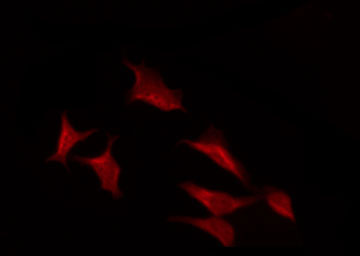RPS6KB1 / P70S6K / S6K Antibody - Staining NIH-3T3 cells by IF/ICC. The samples were fixed with PFA and permeabilized in 0.1% Triton X-100, then blocked in 10% serum for 45 min at 25°C. The primary antibody was diluted at 1:200 and incubated with the sample for 1 hour at 37°C. An Alexa Fluor 594 conjugated goat anti-rabbit IgG (H+L) Ab, diluted at 1/600, was used as the secondary antibody.