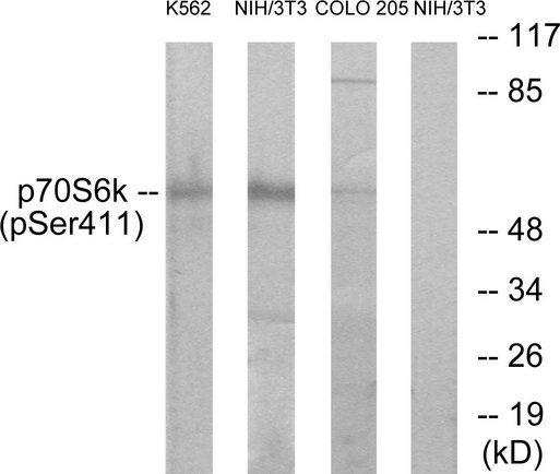 RPS6KB1 / P70S6K / S6K Antibody - Western blot analysis of lysates from K562 cells, NIH/3T3 cells and COLO205 cells, using p70 S6 Kinase (Phospho-Ser411) Antibody. The lane on the right is blocked with the phospho peptide.