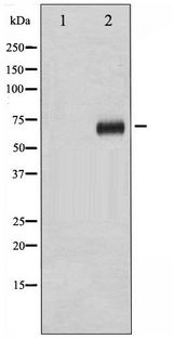 RPS6KB1 / P70S6K / S6K Antibody - Western blot of p70 S6 Kinase phosphorylation expression in Insulin treated HeLa whole cell lysates,The lane on the left is treated with the antigen-specific peptide.