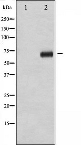 RPS6KB1 / P70S6K / S6K Antibody - Western blot analysis of p70 S6 Kinase phosphorylation expression in Insulin treated HeLa whole cells lysates. The lane on the left is treated with the antigen-specific peptide.