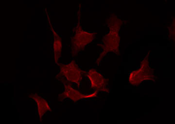 RPS6KB1 / P70S6K / S6K Antibody - Staining NIH-3T3 cells by IF/ICC. The samples were fixed with PFA and permeabilized in 0.1% Triton X-100, then blocked in 10% serum for 45 min at 25°C. The primary antibody was diluted at 1:200 and incubated with the sample for 1 hour at 37°C. An Alexa Fluor 594 conjugated goat anti-rabbit IgG (H+L) Ab, diluted at 1/600, was used as the secondary antibody.