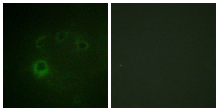 RPS6KB1 / P70S6K / S6K Antibody - Immunofluorescence analysis of COS7 cells, using p70 S6 Kinase (Phospho-Ser418) Antibody. The picture on the right is blocked with the phospho peptide.
