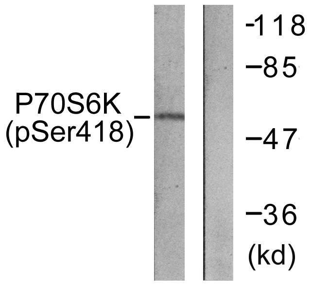RPS6KB1 / P70S6K / S6K Antibody - Western blot analysis of lysates from HT29 cells treated with serum 20% 15', using p70 S6 Kinase (Phospho-Ser418) Antibody. The lane on the right is blocked with the phospho peptide.