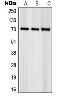 RPS6KB1 / P70S6K / S6K Antibody - Western blot analysis of S6K1 (pS418) expression in NIH3T3 (A); HeLa (B); KNRK (C) whole cell lysates.