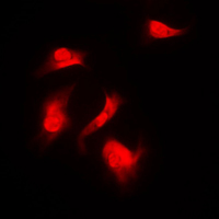 RPS6KB1 / P70S6K / S6K Antibody - Immunofluorescent analysis of S6K1 (pS418) staining in HeLa cells. Formalin-fixed cells were permeabilized with 0.1% Triton X-100 in TBS for 5-10 minutes and blocked with 3% BSA-PBS for 30 minutes at room temperature. Cells were probed with the primary antibody in 3% BSA-PBS and incubated overnight at 4 C in a humidified chamber. Cells were washed with PBST and incubated with a DyLight 594-conjugated secondary antibody (red) in PBS at room temperature in the dark. DAPI was used to stain the cell nuclei (blue).