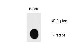 RPS6KB1 / P70S6K / S6K Antibody - Dot blot of anti-RPS6KB1-pS418 Phospho-specific antibody on nitrocellulose membrane. 50ng of Phospho-peptide or Non Phospho-peptide per dot were adsorbed. Antibody working concentrations are 0.5ug per ml.