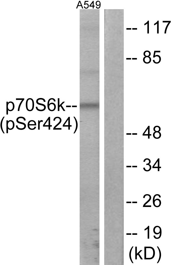 RPS6KB1 / P70S6K / S6K Antibody - Western blot analysis of lysates from A549 cells treated with PMA 125ng/ML 30', using p70 S6 Kinase (Phospho-Ser424) Antibody. The lane on the right is blocked with the phospho peptide.
