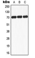 RPS6KB1 / P70S6K / S6K Antibody - Western blot analysis of S6K1 (pS434) expression in K562 insulin-treated (A); mouse brain (B); rat brain (C) whole cell lysates.