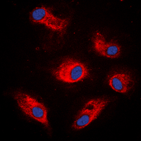 RPS6KB1 / P70S6K / S6K Antibody - Immunofluorescent analysis of S6K1 (pS434) staining in K562 cells. Formalin-fixed cells were permeabilized with 0.1% Triton X-100 in TBS for 5-10 minutes and blocked with 3% BSA-PBS for 30 minutes at room temperature. Cells were probed with the primary antibody in 3% BSA-PBS and incubated overnight at 4 C in a humidified chamber. Cells were washed with PBST and incubated with a DyLight 594-conjugated secondary antibody (red) in PBS at room temperature in the dark. DAPI was used to stain the cell nuclei (blue).