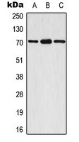 RPS6KB1 / P70S6K / S6K Antibody - Western blot analysis of S6K1 (pS447) expression in A549 EGF-treated (A); mouse brain (B); rat brain (C) whole cell lysates.