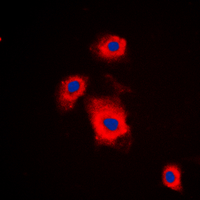 RPS6KB1 / P70S6K / S6K Antibody - Immunofluorescent analysis of S6K1 (pS447) staining in A549 cells. Formalin-fixed cells were permeabilized with 0.1% Triton X-100 in TBS for 5-10 minutes and blocked with 3% BSA-PBS for 30 minutes at room temperature. Cells were probed with the primary antibody in 3% BSA-PBS and incubated overnight at 4 C in a humidified chamber. Cells were washed with PBST and incubated with a DyLight 594-conjugated secondary antibody (red) in PBS at room temperature in the dark. DAPI was used to stain the cell nuclei (blue).