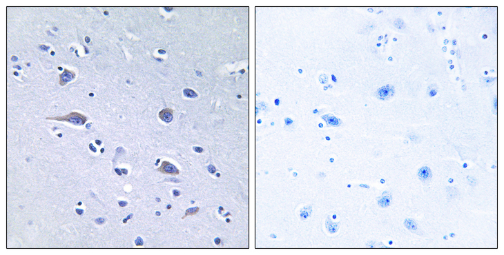 RPS6KB1 / P70S6K / S6K Antibody - Immunohistochemistry analysis of paraffin-embedded human brain, using p70 S6 Kinase (Phospho-Thr229) Antibody. The picture on the right is blocked with the phospho peptide.