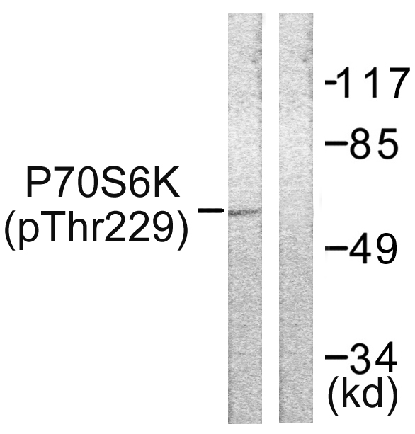 RPS6KB1 / P70S6K / S6K Antibody - Western blot analysis of lysates from Jurkat cells, using p70 S6 Kinase (Phospho-Thr229) Antibody. The lane on the right is blocked with the phospho peptide.