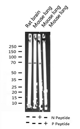 RPS6KB1 / P70S6K / S6K Antibody - Western blot analysis of Phospho-p70 S6 Kinase (Thr229) expression in various lysates