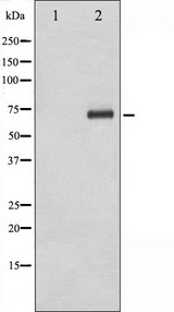 RPS6KB1 / P70S6K / S6K Antibody - Western blot analysis of p70 S6 Kinase phosphorylation expression in Jurkat whole cells lysates. The lane on the left is treated with the antigen-specific peptide.