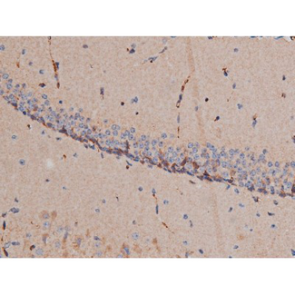 RPS6KB1 / P70S6K / S6K Antibody - 1:200 staining mouse heart tissue by IHC-P. The tissue was formaldehyde fixed and a heat mediated antigen retrieval step in citrate buffer was performed. The tissue was then blocked and incubated with the antibody for 1.5 hours at 22°C. An HRP conjugated goat anti-rabbit antibody was used as the secondary.
