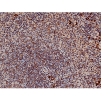 RPS6KB1 / P70S6K / S6K Antibody - 1:200 staining mouse spleen tissue by IHC-P. The tissue was formaldehyde fixed and a heat mediated antigen retrieval step in citrate buffer was performed. The tissue was then blocked and incubated with the antibody for 1.5 hours at 22°C. An HRP conjugated goat anti-rabbit antibody was used as the secondary.