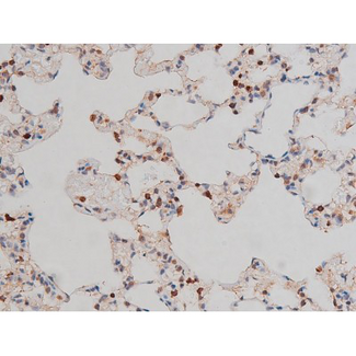 RPS6KB1 / P70S6K / S6K Antibody - 1:200 staining rat lung tissue by IHC-P. The tissue was formaldehyde fixed and a heat mediated antigen retrieval step in citrate buffer was performed. The tissue was then blocked and incubated with the antibody for 1.5 hours at 22°C. An HRP conjugated goat anti-rabbit antibody was used as the secondary.