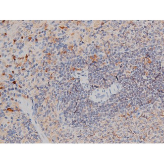 RPS6KB1 / P70S6K / S6K Antibody - 1:200 staining rat spleen tissue by IHC-P. The tissue was formaldehyde fixed and a heat mediated antigen retrieval step in citrate buffer was performed. The tissue was then blocked and incubated with the antibody for 1.5 hours at 22°C. An HRP conjugated goat anti-rabbit antibody was used as the secondary.