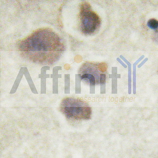 RPS6KB1 / P70S6K / S6K Antibody - 1/100 staining human brain tissue by IHC-P. The sample was formaldehyde fixed and a heat mediated antigen retrieval step in citrate buffer was performed. The sample was then blocked and incubated with the antibody for 1.5 hours at 22°C. An HRP conjugated goat anti-rabbit antibody was used as the secondary antibody.