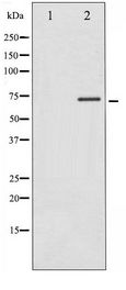 RPS6KB1 / P70S6K / S6K Antibody - Western blot of p70 S6 Kinase phosphorylation expression in Insulin treated Jurkat whole cell lysates,The lane on the left is treated with the antigen-specific peptide.