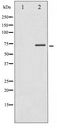 RPS6KB1 / P70S6K / S6K Antibody - Western blot of p70 S6 Kinase phosphorylation expression in Insulin treated Jurkat whole cell lysates,The lane on the left is treated with the antigen-specific peptide.