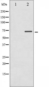 RPS6KB1 / P70S6K / S6K Antibody - Western blot analysis of p70 S6 Kinase phosphorylation expression in Insulin treated Jurkat whole cells lysates. The lane on the left is treated with the antigen-specific peptide.