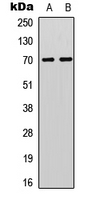 RPS6KB1 / P70S6K / S6K Antibody - Western blot analysis of S6K1 (pT412) expression in LOVO (A); Jurkat (B) whole cell lysates.