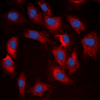 RPS6KB1 / P70S6K / S6K Antibody - Immunofluorescent analysis of S6K1 (pT412) staining in LOVO cells. Formalin-fixed cells were permeabilized with 0.1% Triton X-100 in TBS for 5-10 minutes and blocked with 3% BSA-PBS for 30 minutes at room temperature. Cells were probed with the primary antibody in 3% BSA-PBS and incubated overnight at 4 deg C in a humidified chamber. Cells were washed with PBST and incubated with a DyLight 594-conjugated secondary antibody (red) in PBS at room temperature in the dark. DAPI was used to stain the cell nuclei (blue).