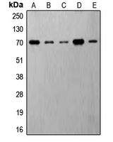 RPS6KB1 / P70S6K / S6K Antibody - Western blot analysis of S6K1 (pT421) expression in MDAMB231 insulin-treated (A); Jurkat (B); HeLa (C); NIH3T3 (D); PC12 (E) whole cell lysates.