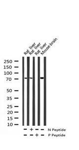 RPS6KB1 / P70S6K / S6K Antibody - Western blot analysis of Phospho-p70 S6 Kinase (Thr421) expression in various lysates