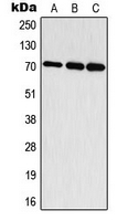 RPS6KB1 / P70S6K / S6K Antibody - Western blot analysis of S6K1 (pT444) expression in HepG2 EGF-treated (A); mouse brain (B); rat brain (C) whole cell lysates.