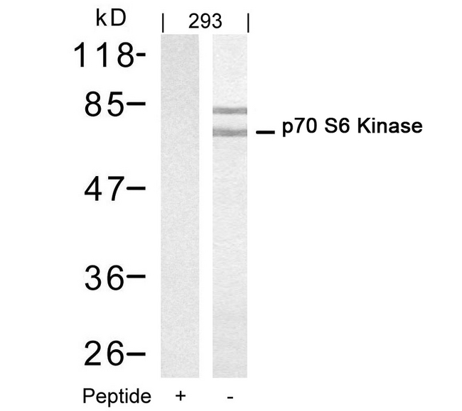 RPS6KB1 / P70S6K / S6K Antibody - Western blot of extracts from 293 cells using p70 S6 Kinase(Ab-421) antibody(Lane 2) and the same antibody preincubated with blocking peptide(Lane1).