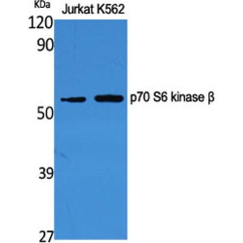 RPS6KB2 / S6K2 Antibody - Western blot of p70 S6 kinase beta antibody