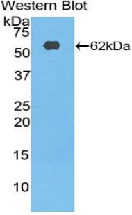 RPS6KB2 / S6K2 Antibody - Western blot of recombinant RPS6KB2 / S6K2.  This image was taken for the unconjugated form of this product. Other forms have not been tested.