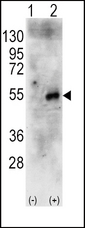 RPS6KB2 / S6K2 Antibody - Western blot of RPS6KB2 (arrow) using rabbit polyclonal RPS6KB2 Antibody (RB11689). 293 cell lysates (2 ug/lane) either nontransfected (Lane 1) or transiently transfected with the human RPS6KB2 gene (Lane 2) (Origene Technologies).