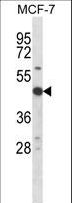 RPS6KB2 / S6K2 Antibody - Mouse Rps6kb2 Antibody western blot of MCF-7 cell line lysates (35 ug/lane). The Rps6kb2 antibody detected the Rps6kb2 protein (arrow).