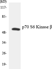 RPS6KB2 / S6K2 Antibody - Western blot analysis of the lysates from HUVECcells using p70 S6 Kinase Î² antibody.