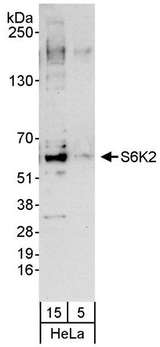 RPS6KB2 / S6K2 Antibody - Detection of Human S6K2 by Western Blot. Samples: Whole cell lysate (5 and 15 ug) from HeLa cells. Antibody: Affinity purified rabbit anti-S6K2 antibody used at 0.04 ug/ml for WB. Detection: Chemiluminescence with an exposure time of 30 seconds.