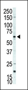 RPS6KB2 / S6K2 Antibody - Western blot of anti-p70S6Kbeta antibody in A375 cell lysate. p70S6Kbeta (arrow) was detected using purified antibody. Secondary HRP-anti-rabbit was used for signal visualization with chemiluminescence.