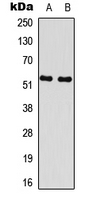 RPS6KB2 / S6K2 Antibody - Western blot analysis of S6K2 expression in Jurkat (A); K562 (B) whole cell lysates.